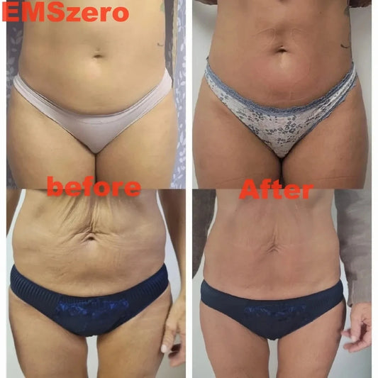 Slimming Sculpting Fat Burning Muscle Stimulator