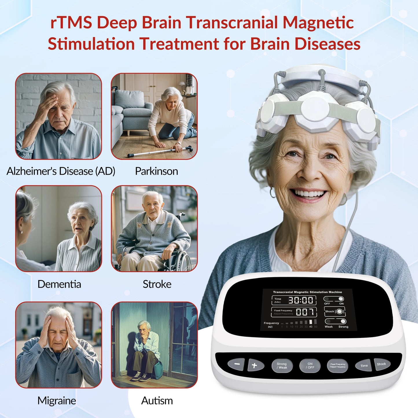 Transcranial Magnetic Stimulator for Treatment of Parkinson Insomnia Anxiety Depression