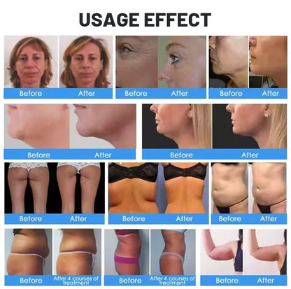 Body Shaping And Beauty Equipment