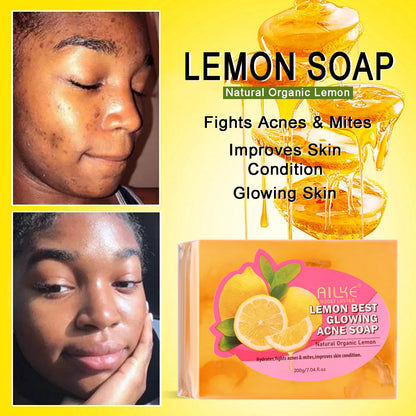 Dark Spots and Acne Remover Soap Bar, Whitening Skin with Natural Lemon, Olive Oil, Face and Body Wash