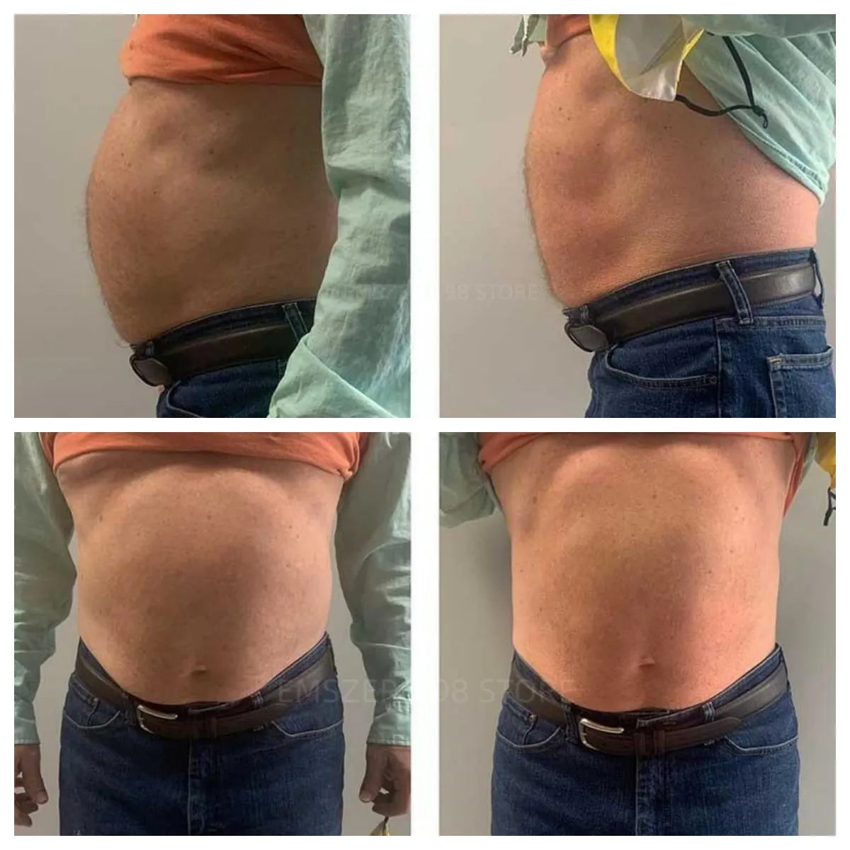 Slimming Sculpting Fat Burning Muscle Stimulator