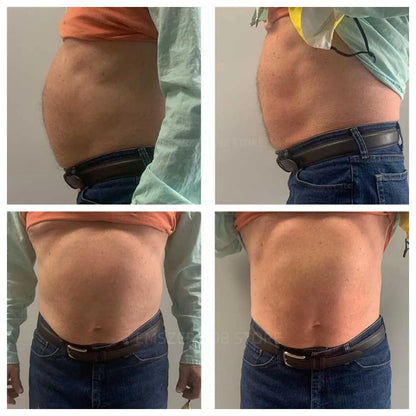 Slimming Sculpting Fat Burning Muscle Stimulator